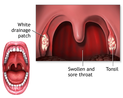 Find Relief for Your Throat: Top Throat Specialists in Mumbai